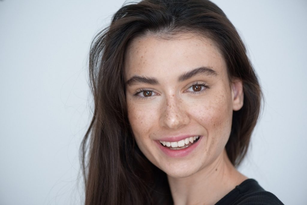 Zima - dobry czas na walkę z przebarwieniami na skórze - FEMNEWS.pl przebarwienia na skorze