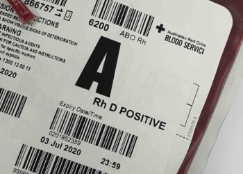 krew-podczas-porodu-ile-tracimy-i-kiedy-to-moze-byc-niebezpieczne