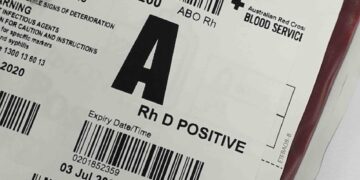 krew-podczas-porodu-ile-tracimy-i-kiedy-to-moze-byc-niebezpieczne