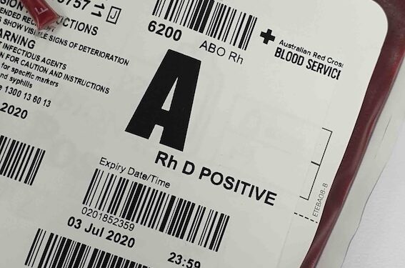 krew-podczas-porodu-ile-tracimy-i-kiedy-to-moze-byc-niebezpieczne